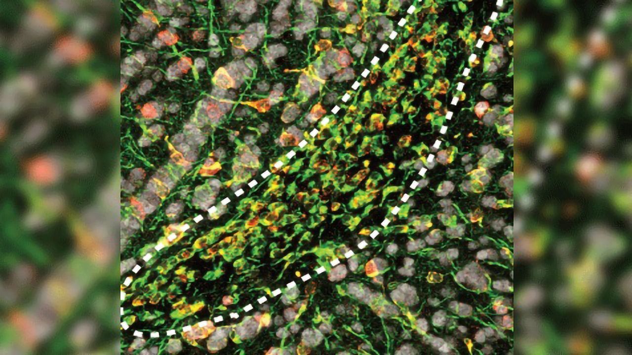 Neuronal Stem Cell Genes on Standby to Exit "Stemness"