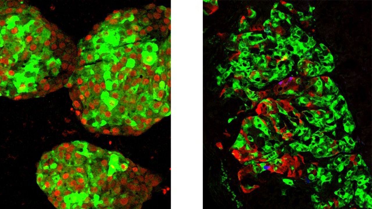 Mimicking Clustering of Immature Beta Cells Yields Stem Cell Breakthrough