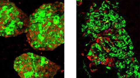 Mimicking Clustering of Immature Beta Cells Yields Stem Cell Breakthrough