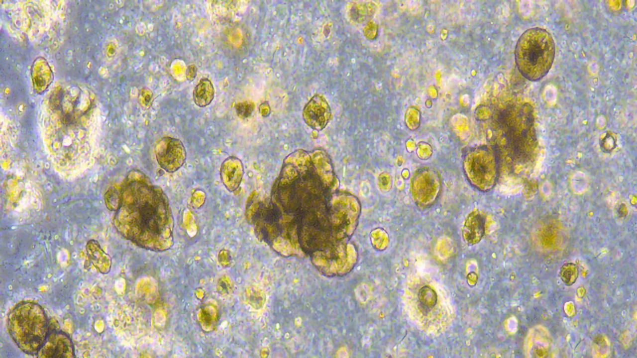 100 Cancer Organoid Models Will Soon Be Available for Researchers
