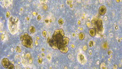 100 Cancer Organoid Models Will Soon Be Available for Researchers