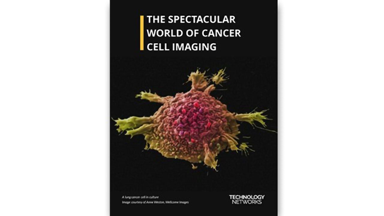 The Spectacular World of Cancer Cell Imaging