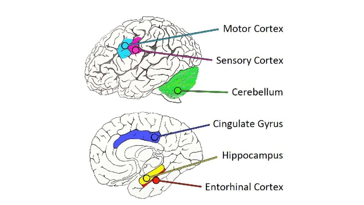 A Map to the Alzheimer's Brain