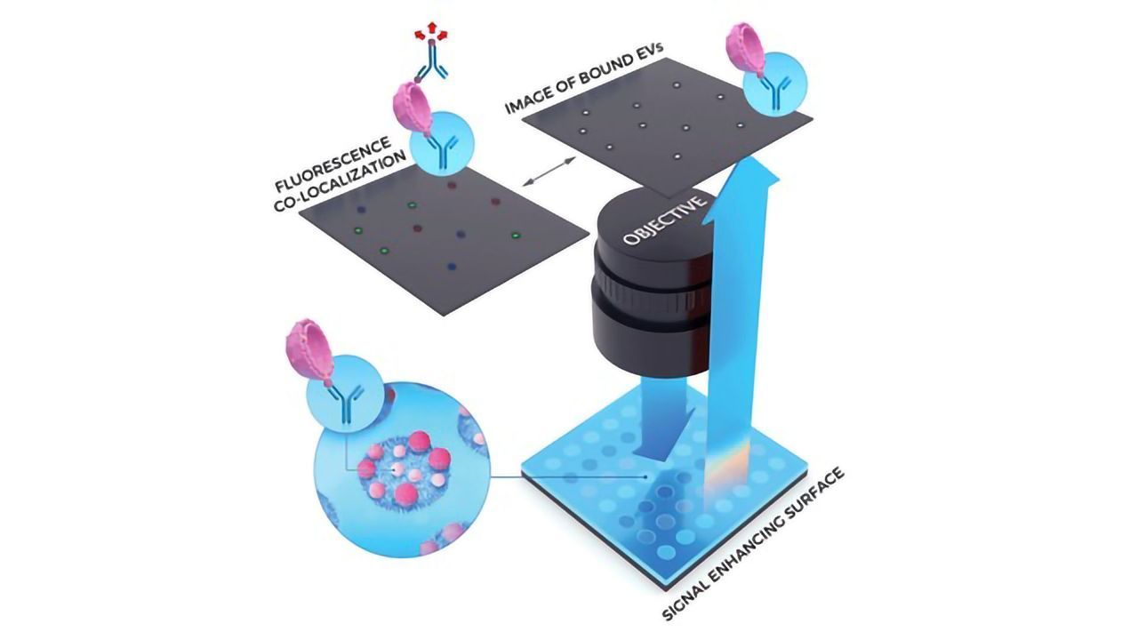 NanoView Biosciences Launches ExoView Platform for Reliable Exosome Biomarker Characterization