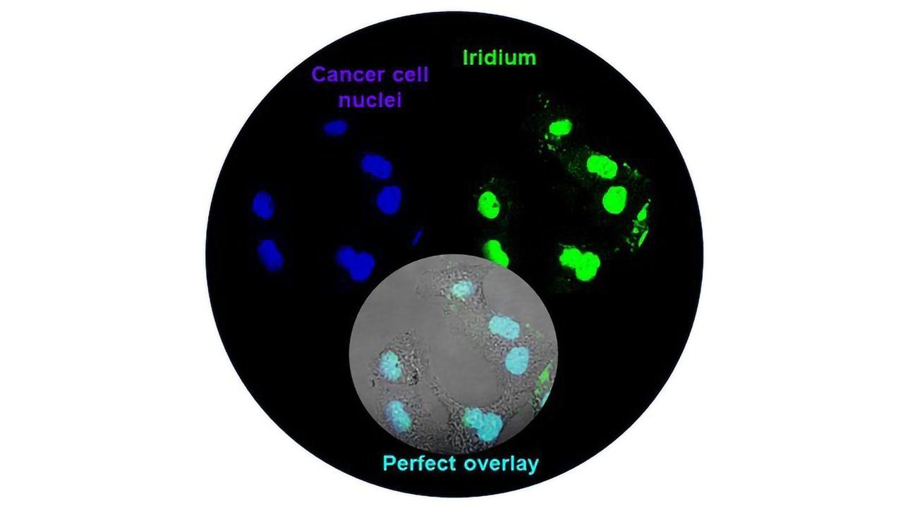 Meteorite-derived Metal is a Candidate for Photodynamic Cancer Therapy