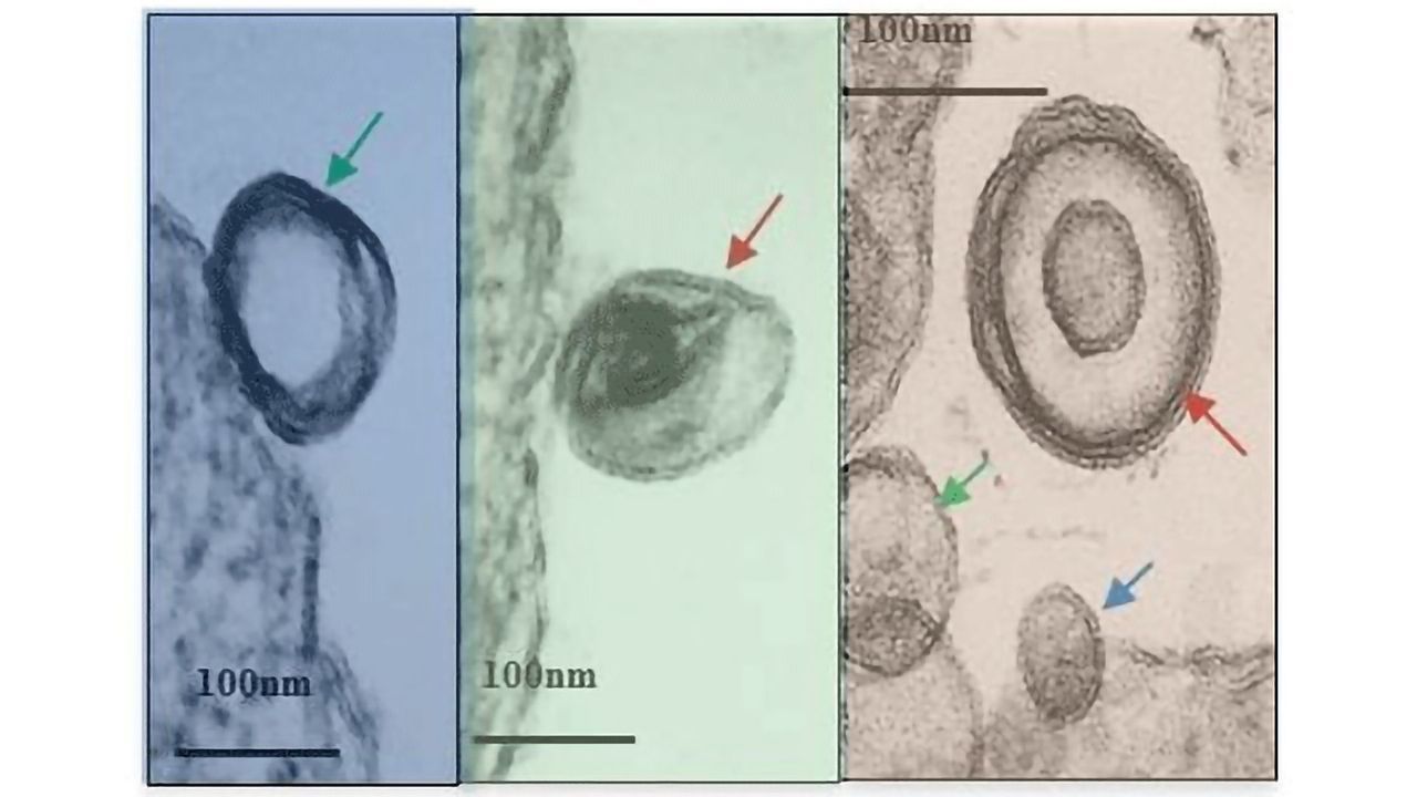 Exosome-hacking Boosts Leishmania Infections
