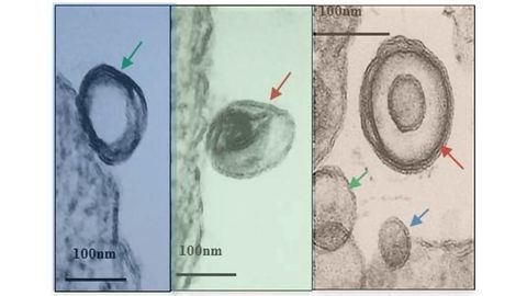 Exosome-hacking Boosts Leishmania Infections