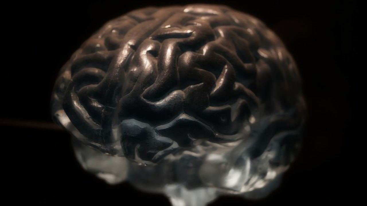 Normal Brain Aging Patterns Occur at a Faster Rate in People With Psychosis