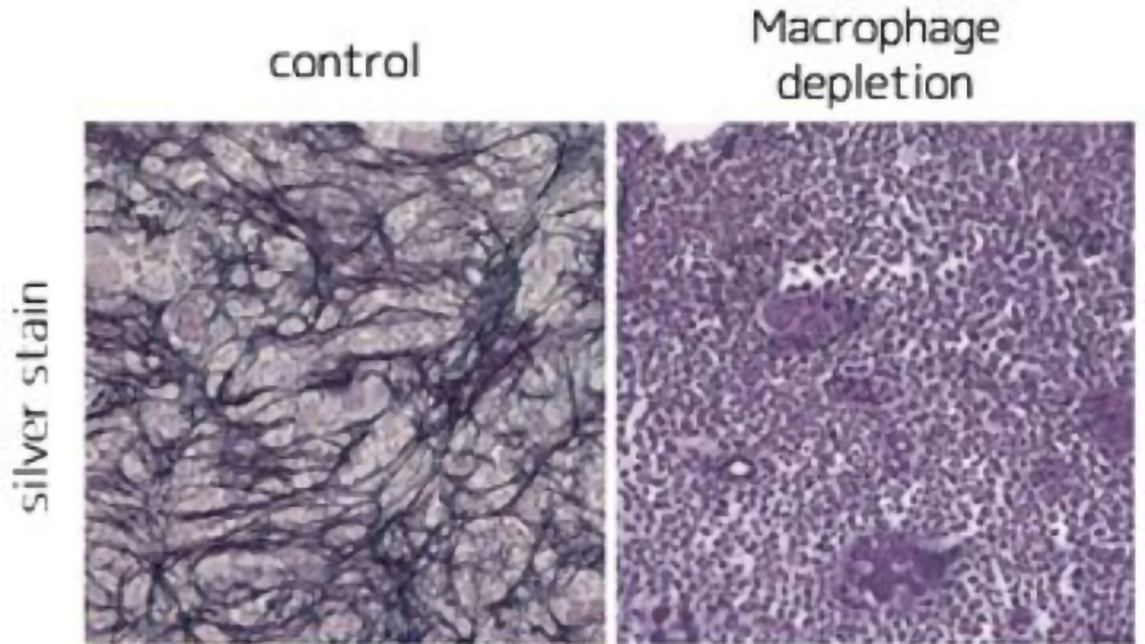 Vitamin D and Macrophages Drive Bone Marrow Disease