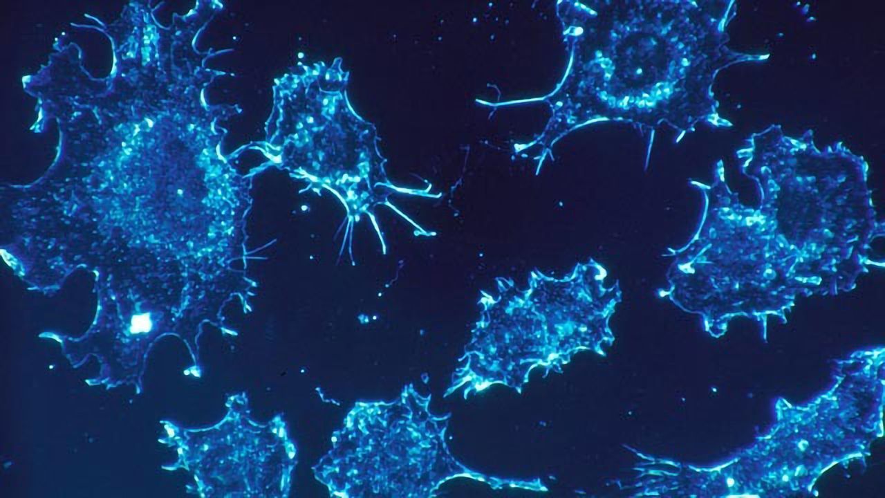 Could an Over-abundance of Energy Be Fueling Cancer?