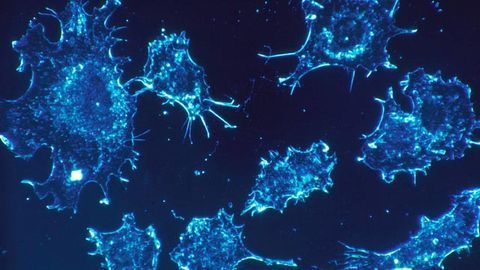 Could an Over-abundance of Energy Be Fueling Cancer?