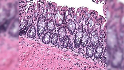 TRADD: Not a Dispensable Player in Cell Survival as First Thought