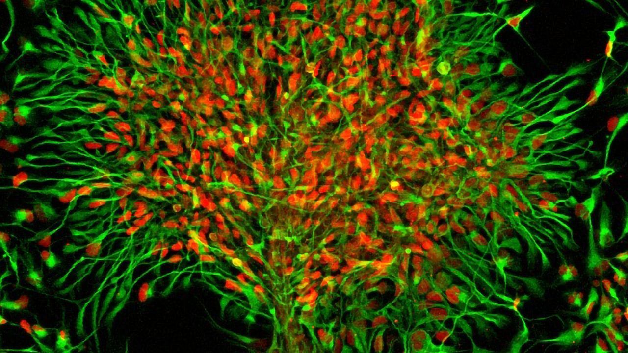 Uncovering the Evolution of the Brain