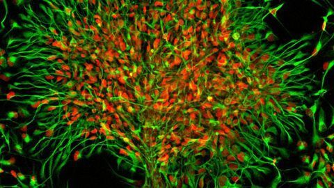 Uncovering the Evolution of the Brain