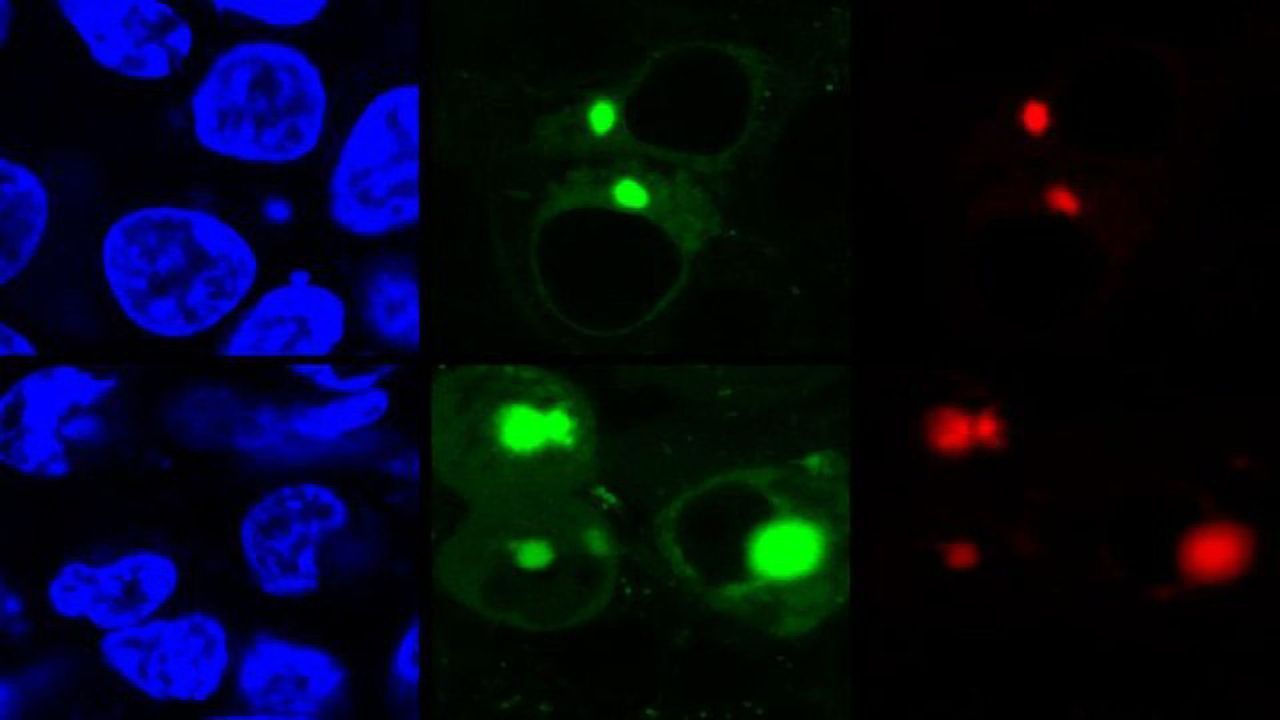 "Turn-on" Fluorescence Shines Light on Protein Misfolding