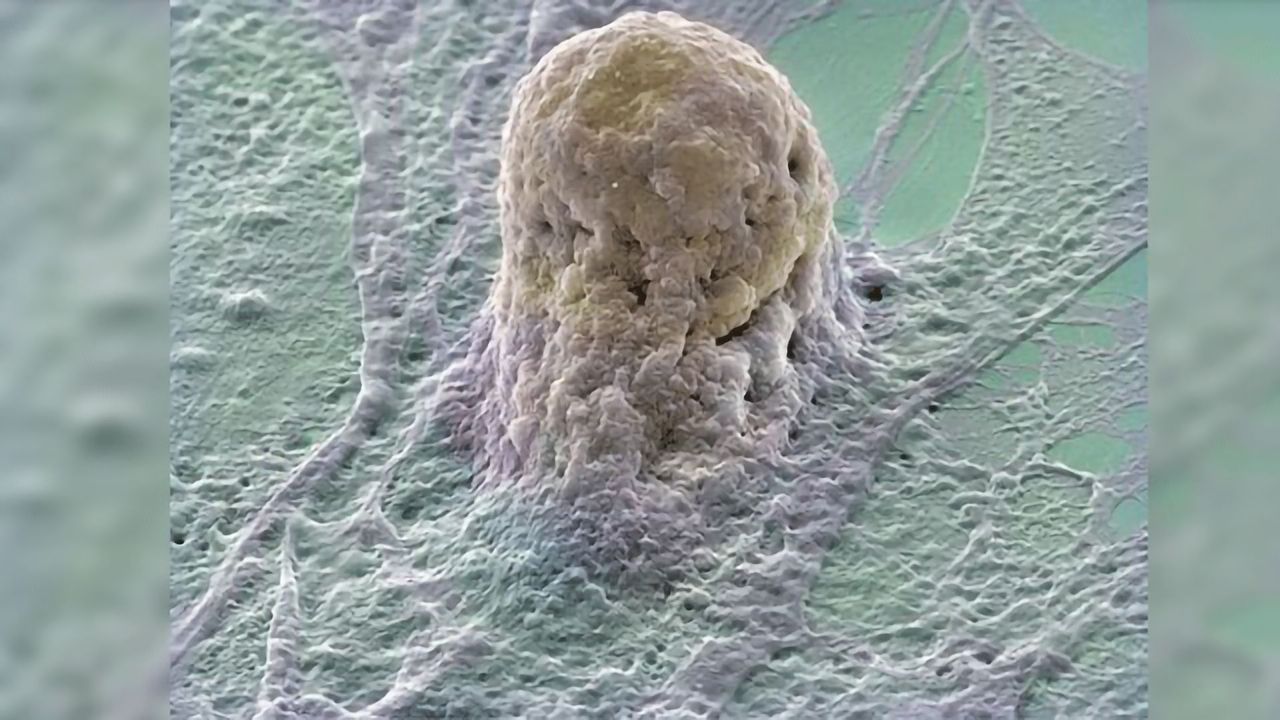 Measles Virus Vector Used to Streamline Cell Reprogramming