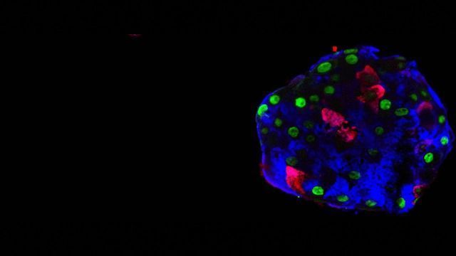 Diabetes: Human Cells Can Also Change Jobs content piece image 