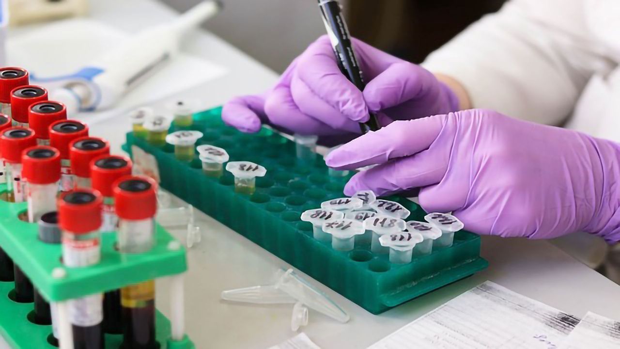 "Good" Cholesterol Likened to "Velcro Ball"