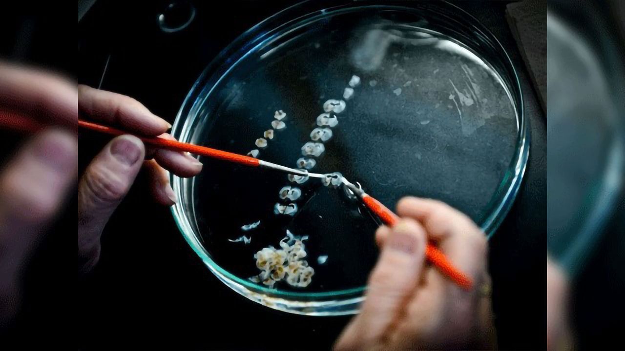 Possibilities for Stem Cell Therapy in Parkinson's Highlighted