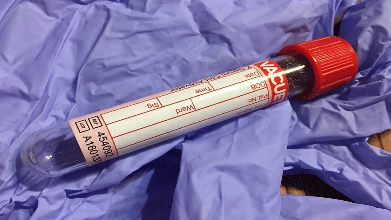 Blood Gene Expression Markers Predictive of Pain
