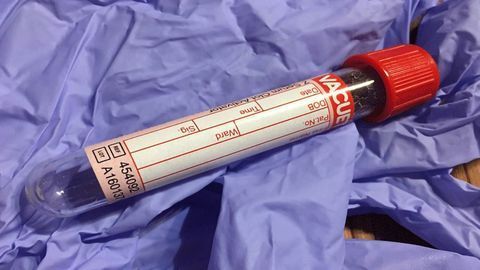 Blood Gene Expression Markers Predictive of Pain
