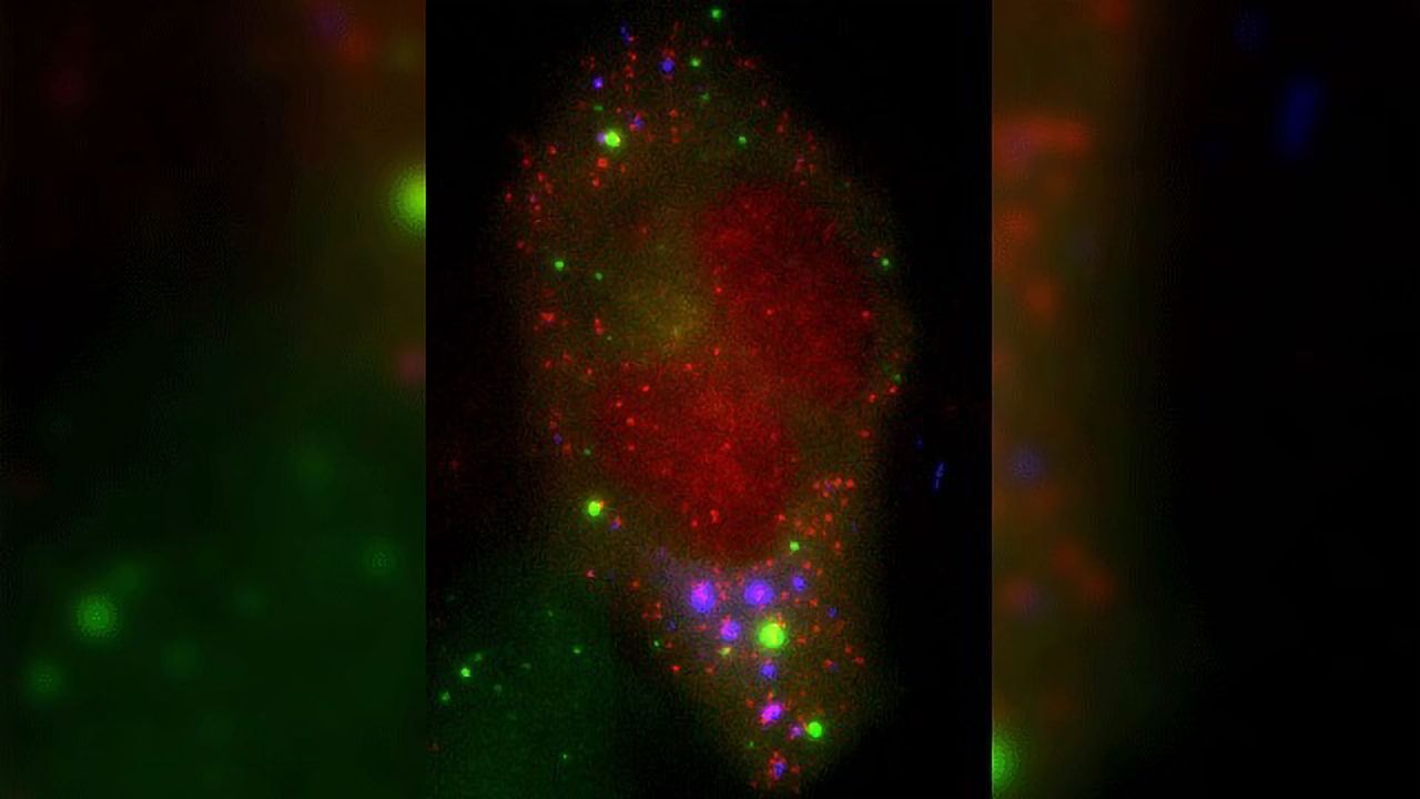 RNA Captured Interacting With Stress Granules