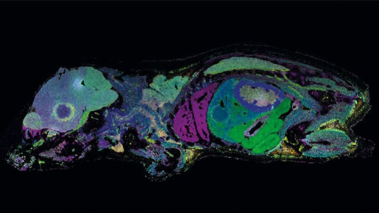 Pharmaceutical R&D Powered by MALDI Mass Spectrometry Imaging