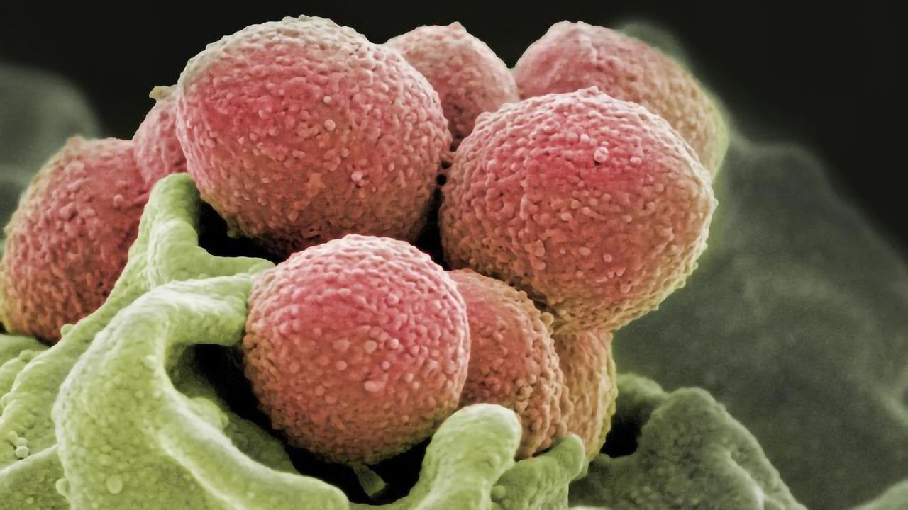 Trigger that Turns Strep Into a Flesh-eater