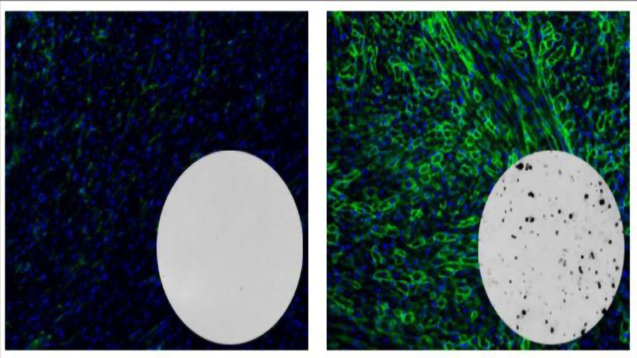 One Year Later: CRISPR Success in Duchenne Muscular Dystrophy Model