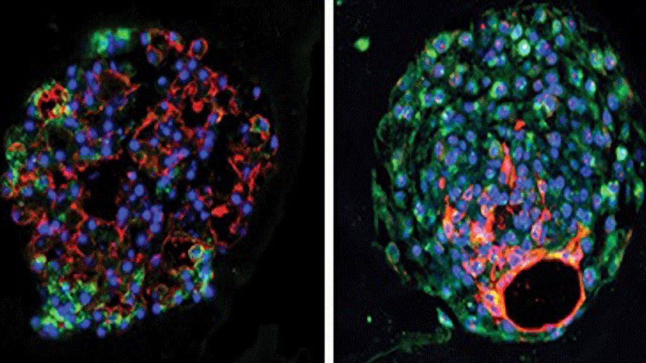 Lung Therapy Targets Derived From Fetal Signaling Pathways