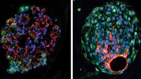 Lung Therapy Targets Derived From Fetal Signaling Pathways