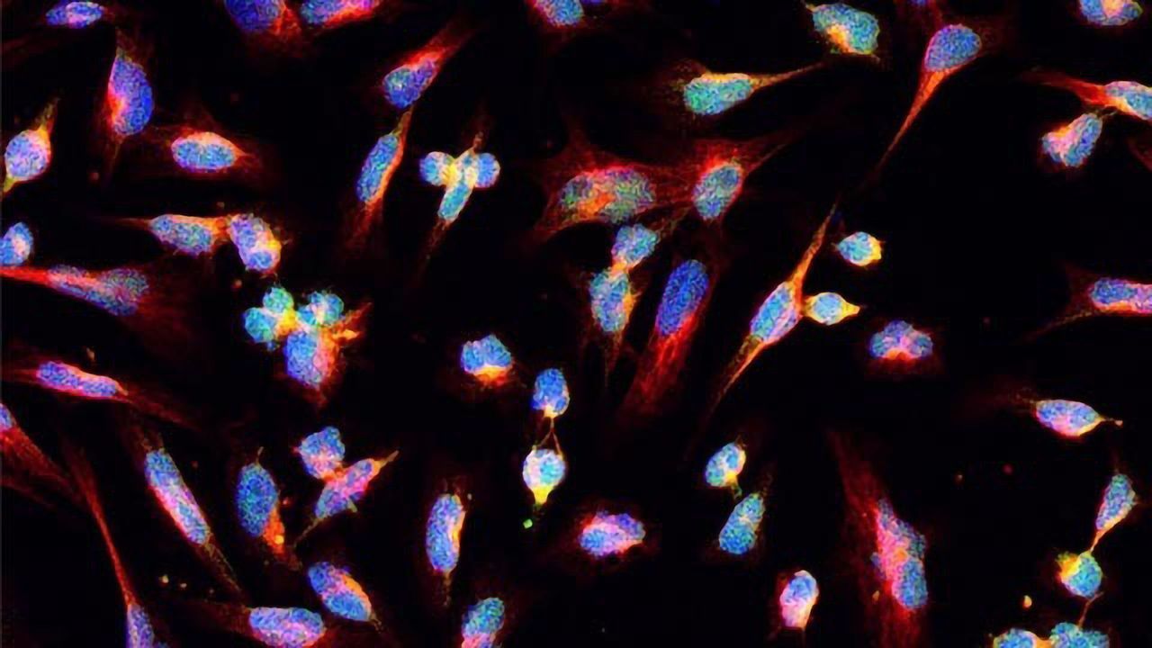 Blueprint Guides Treatment of Deadly Brain Tumor