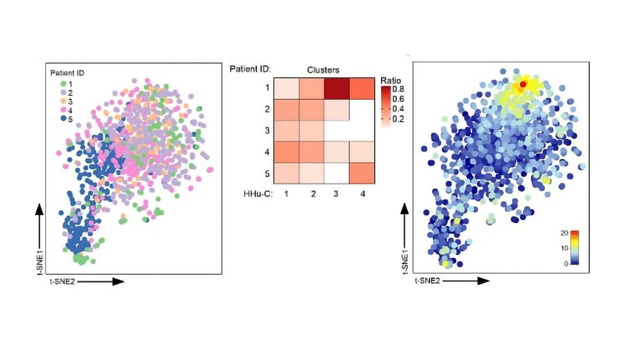 A New Map of the Brain's Immune System