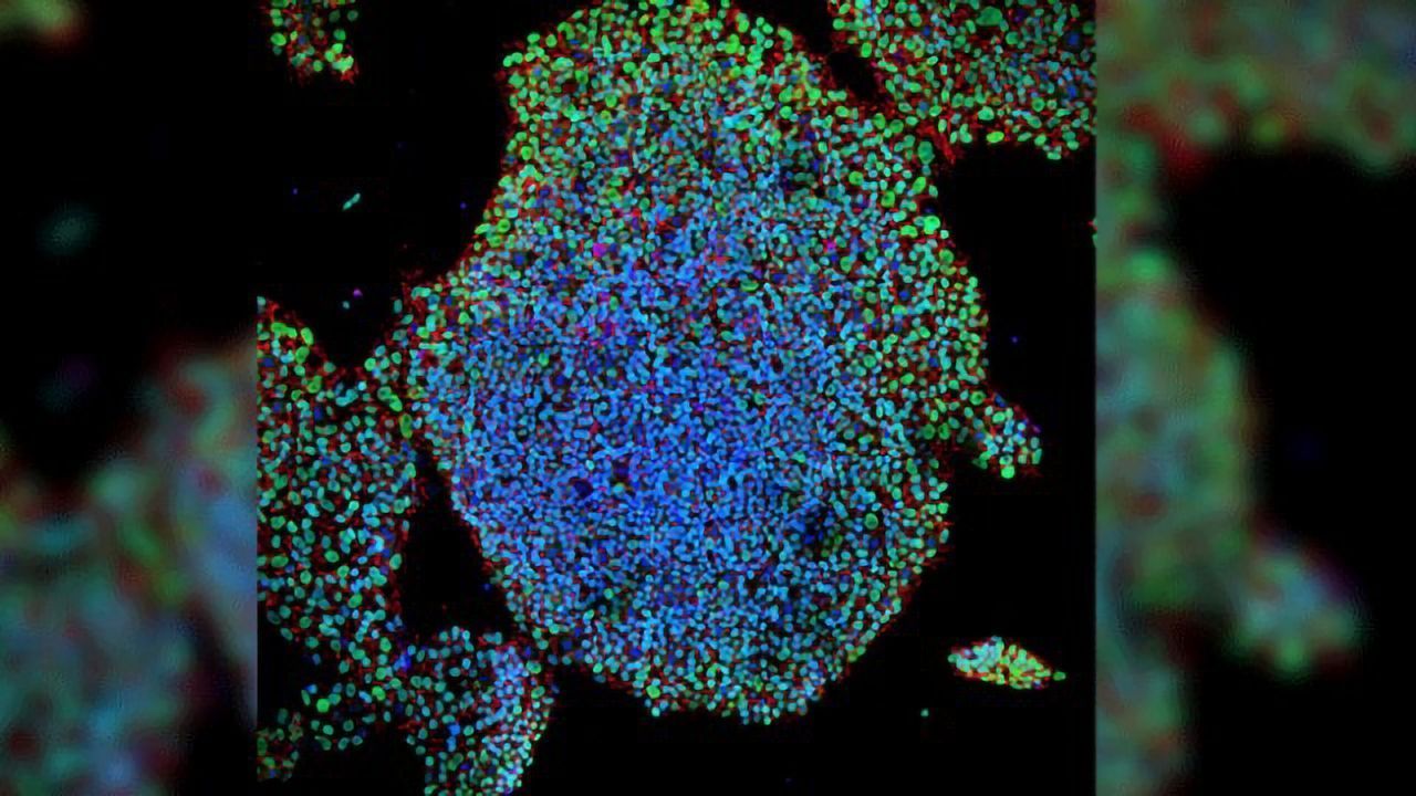 Engineered "Suicide Genes" Safely Grow Beta Cells From Stem Cells
