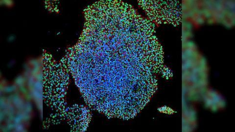 Engineered "Suicide Genes" Safely Grow Beta Cells From Stem Cells
