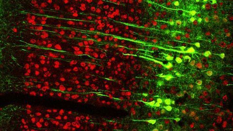 New Study in Mice Reveals Unexpected Place for Learning, Memory in the Brain