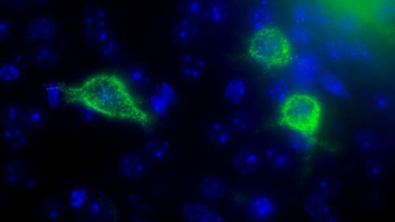 Vitamin D Deficiency Linked to Loss in Brain Plasticity