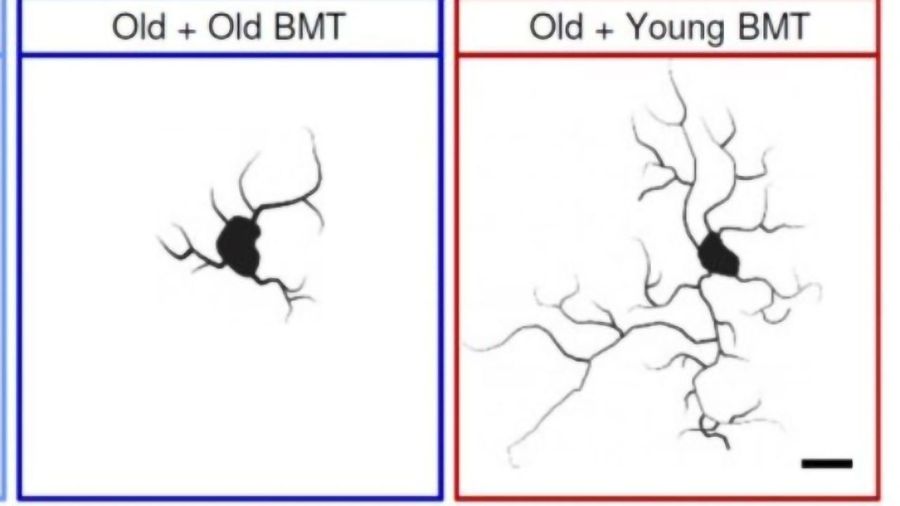 Young Bone Marrow Rejuvenates Aging Mouse Brains, New Study Finds