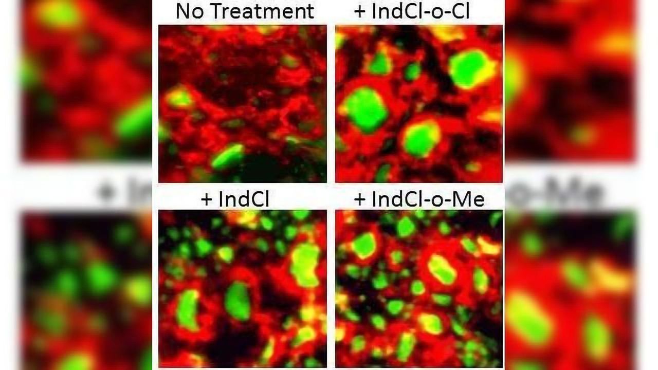 Could a Superior Therapeutic Approach for MS Be on the Horizon?