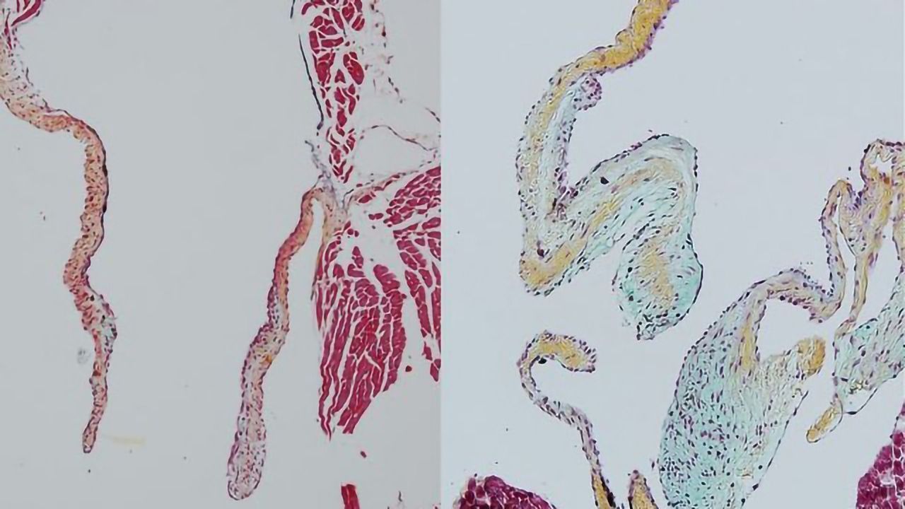 Revealing the Critical Role of Heart-derived Macrophages