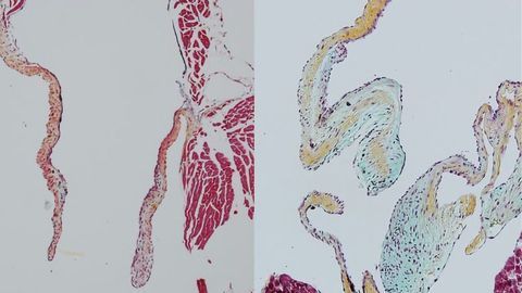 Revealing the Critical Role of Heart-derived Macrophages