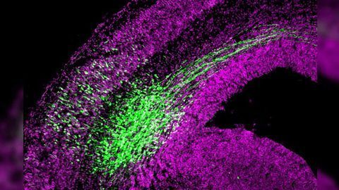 Akna Protein Lives in Centrosome and Regulates Neural Stem Cell Differentiation