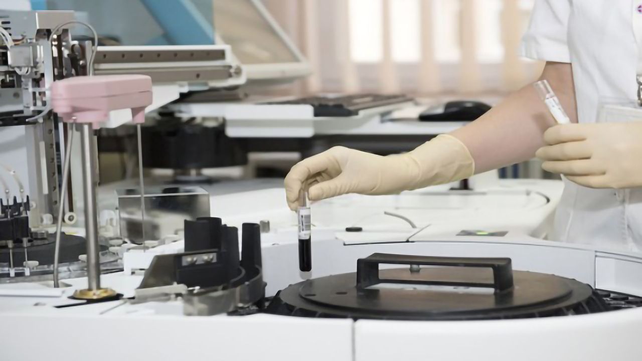 Human Gene Linked to a Better Recovery From Stroke