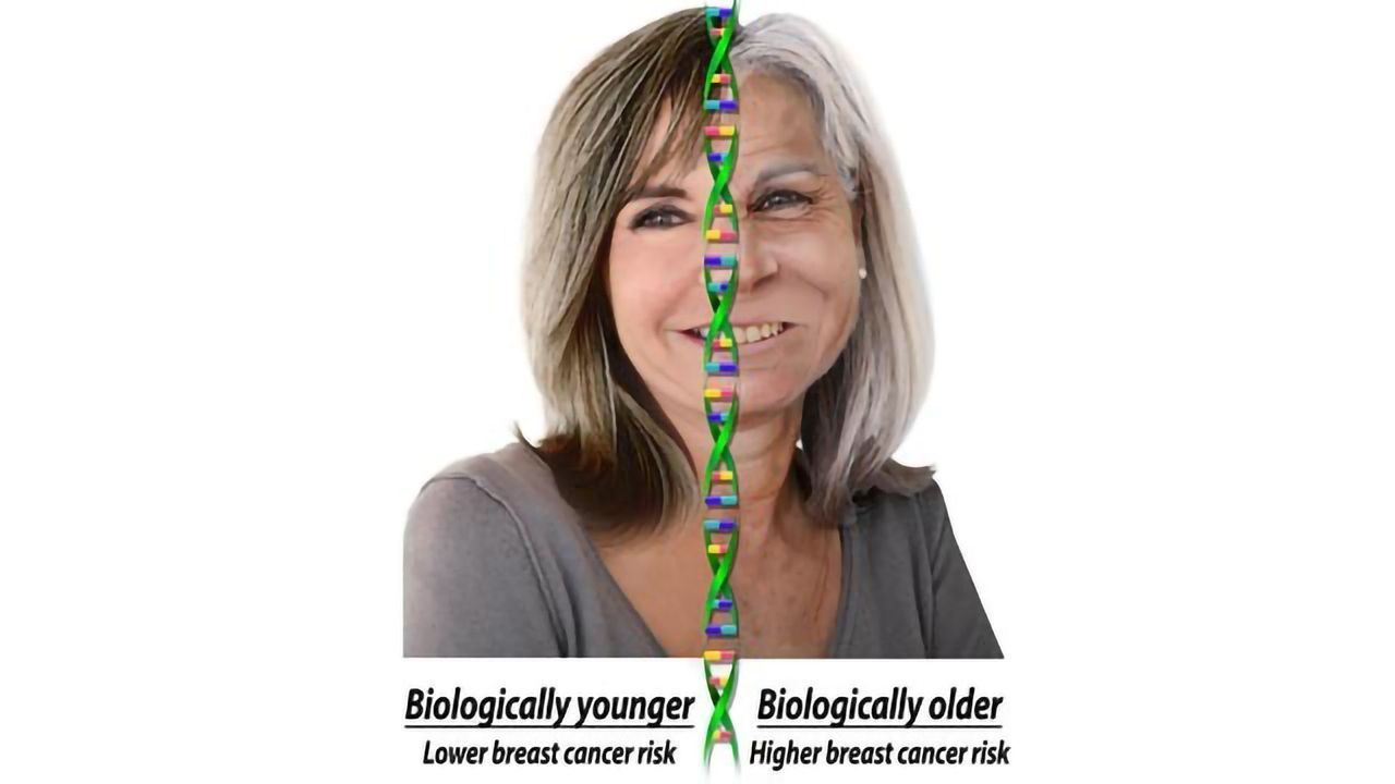 Older Biologic Age Linked to Increased Breast Cancer Risk