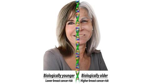 Older Biologic Age Linked to Increased Breast Cancer Risk