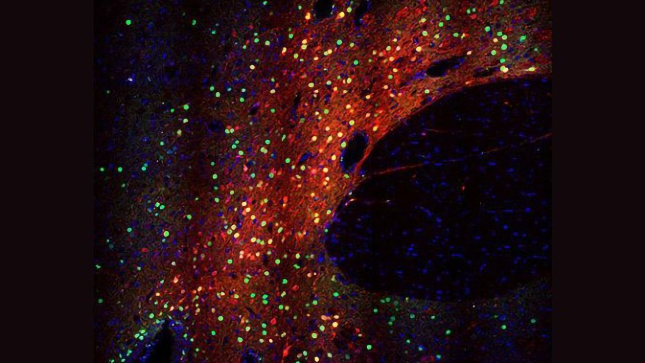 CRISPR Tool Targets Neurons