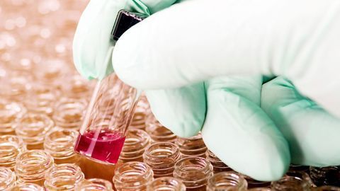 Gene May Predict the Development of Pancreatic Cancer