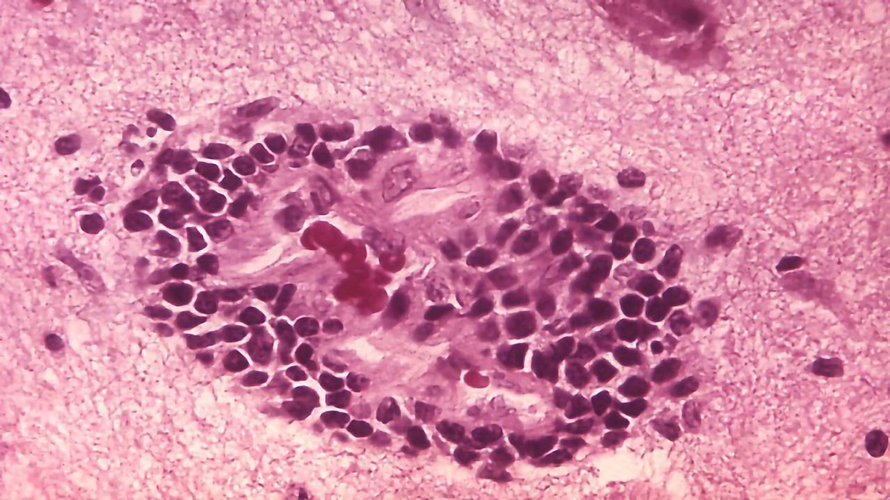 Establishing Immune Memory to Rabies in the CNS