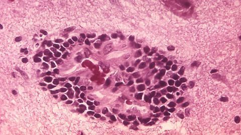 Establishing Immune Memory to Rabies in the CNS