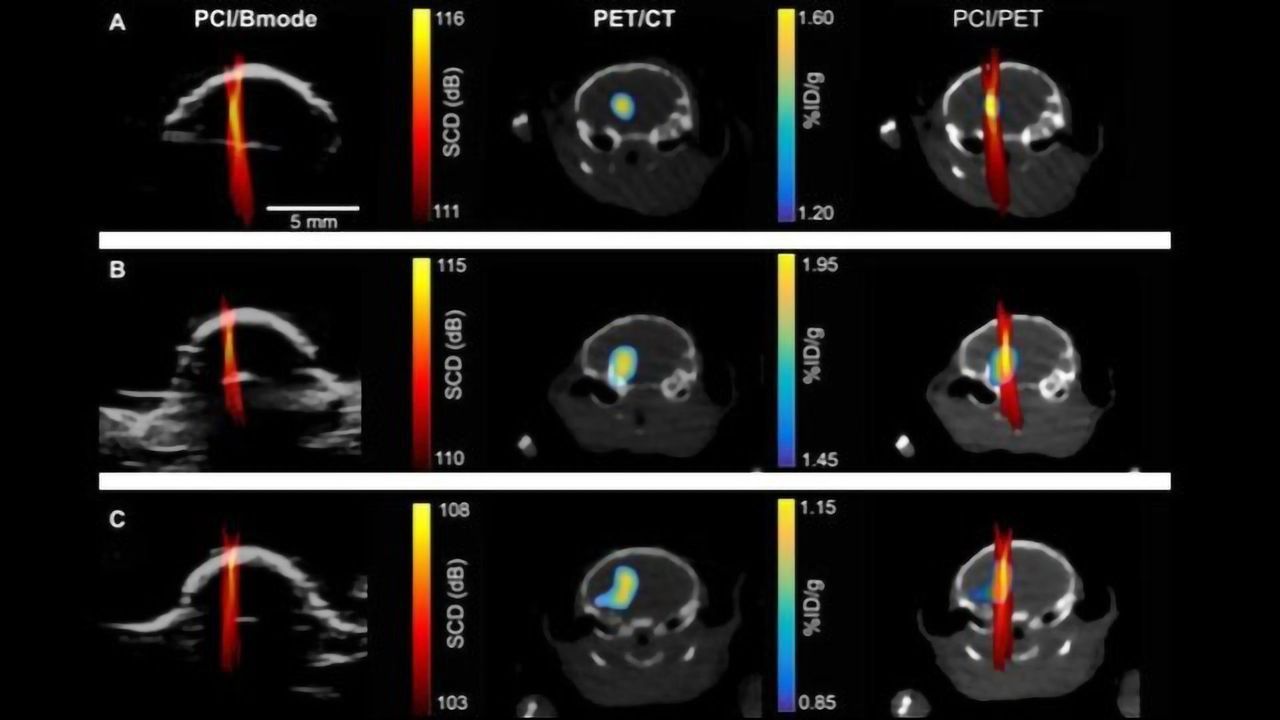 Adopting a “Painting by Numbers” Approach for Precise Drug Delivery